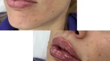 Клиника красоты МариЛав на Таганской улице изображение 20