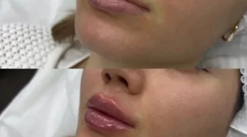 Клиника красоты МариЛав на Таганской улице изображение 10